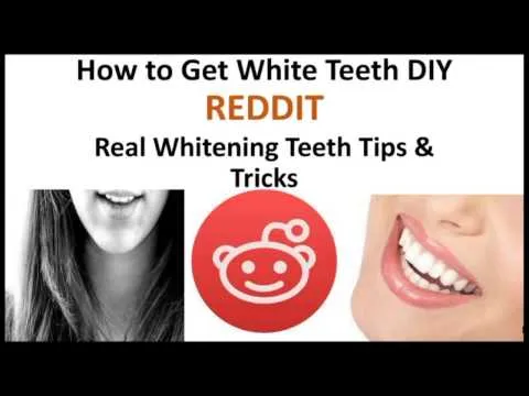 33760 in office whitening