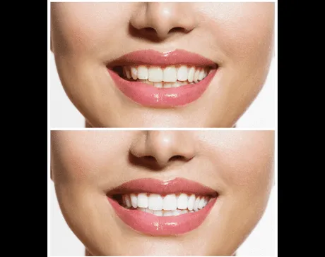 33765 dentist consultation