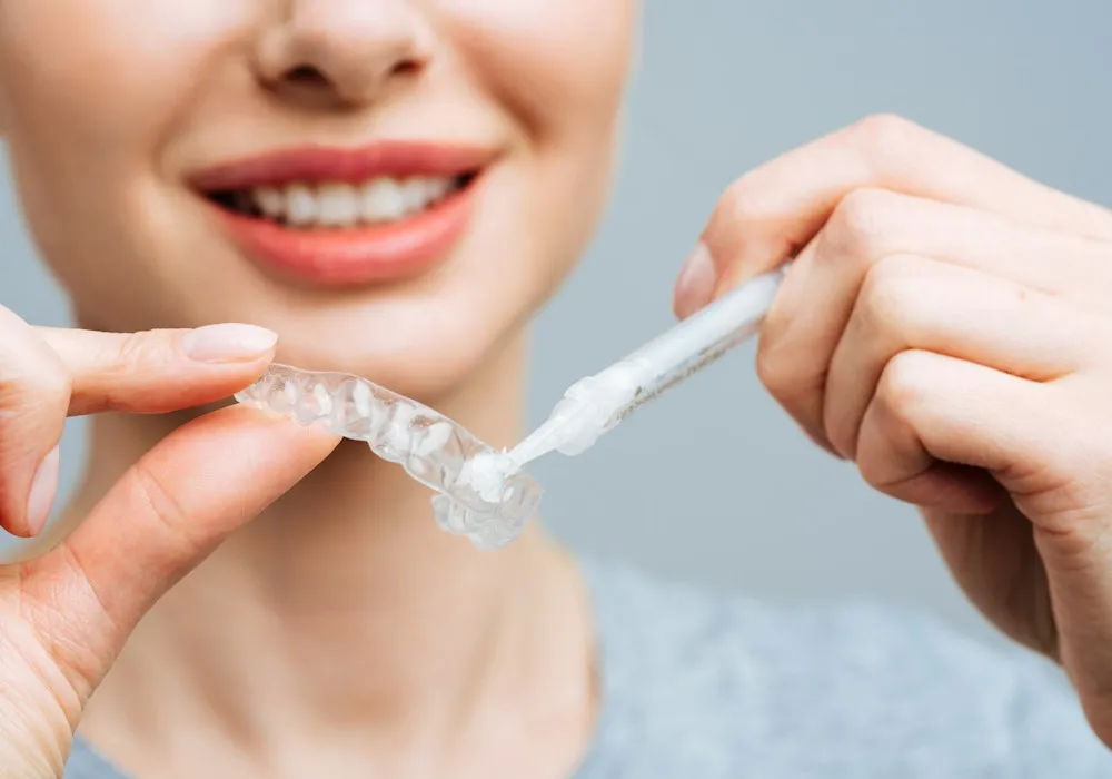 33769 teeth whitening orlando park at home kits