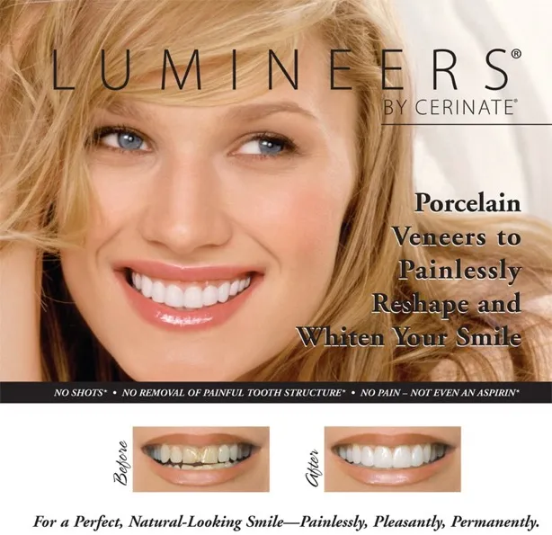 33772 lumineers whitening candidates