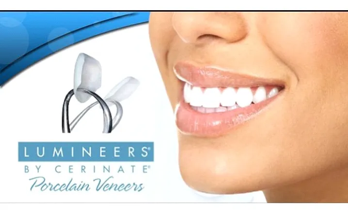 33772 lumineers whitening dentist