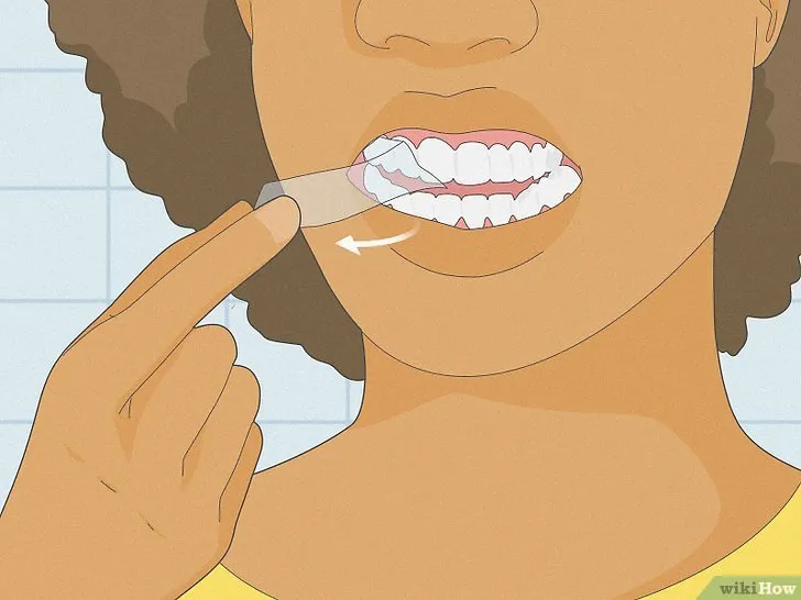 33774 bright smile teeth