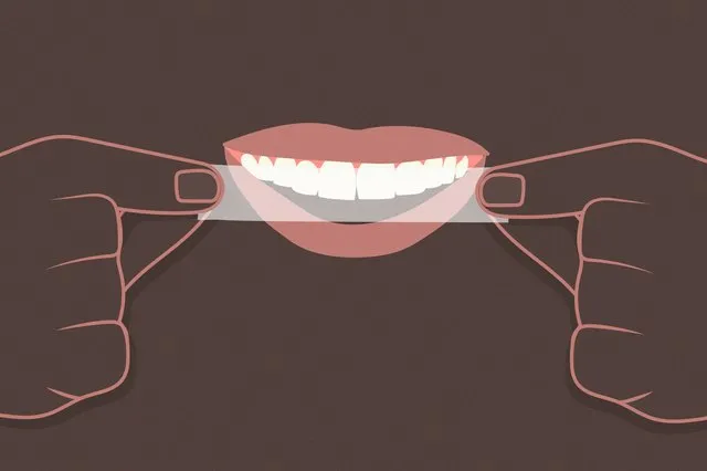 33775 dentist teeth whitening