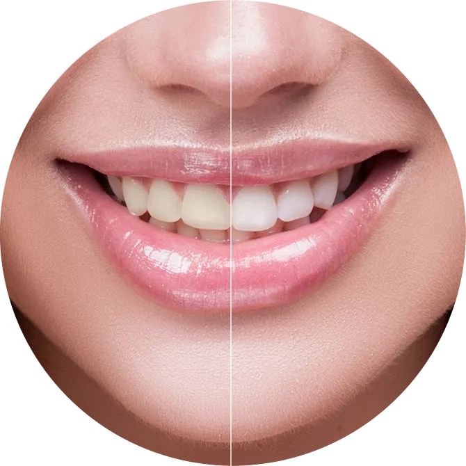 33778 teeth whitening aftercare