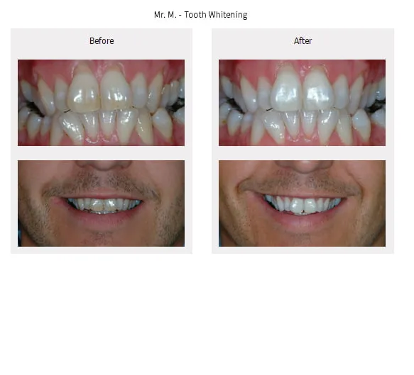 33783 dentist consultation