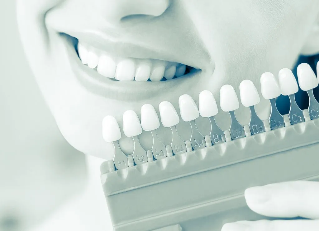 33783 tooth whitening york banner