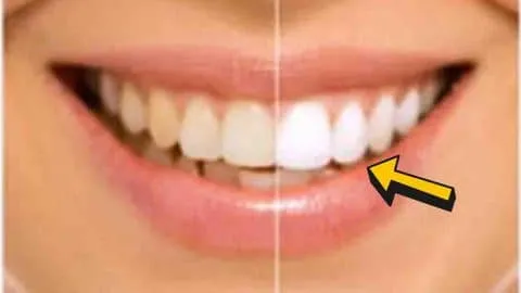 33784 homemade teeth whitening