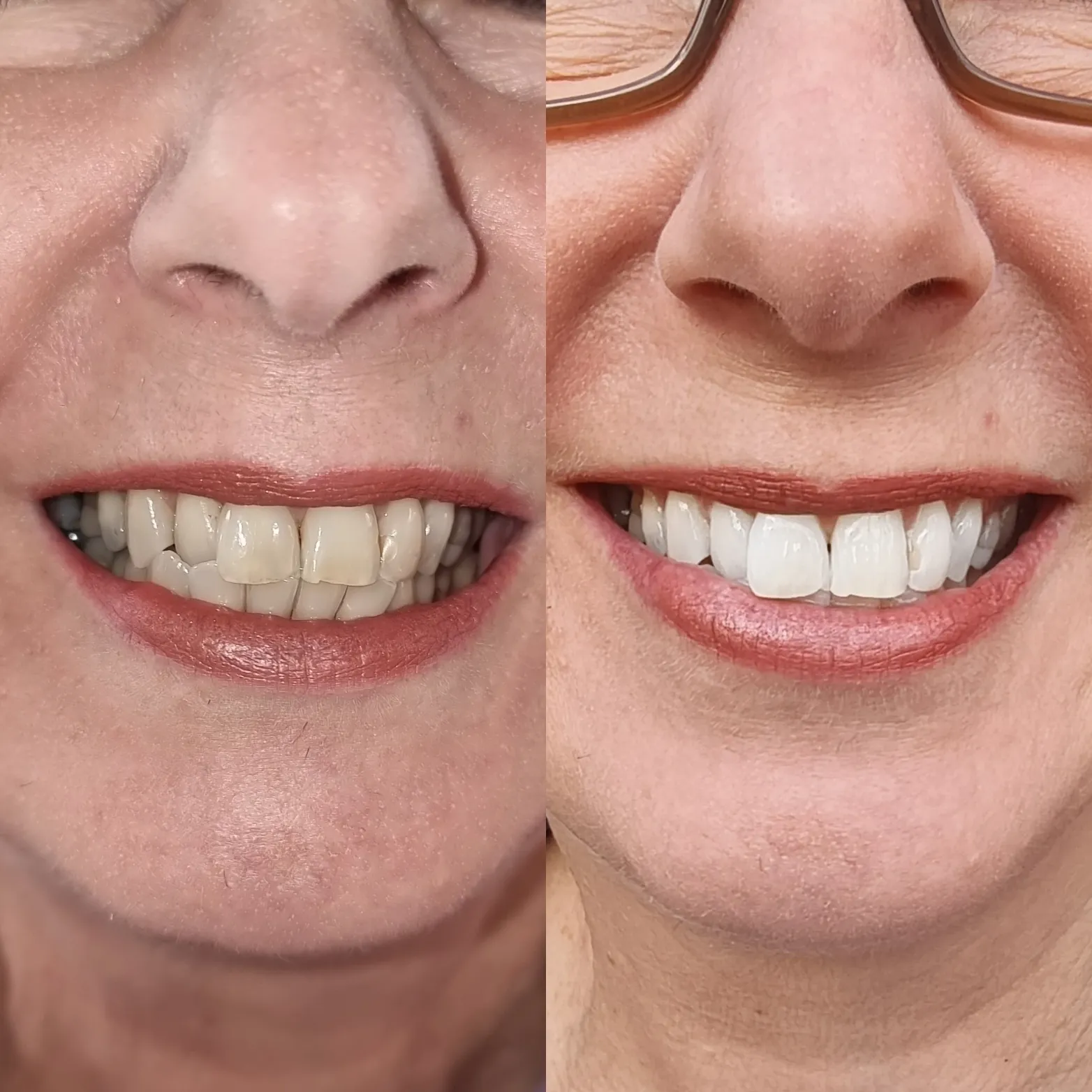 33788 whitening toothpaste