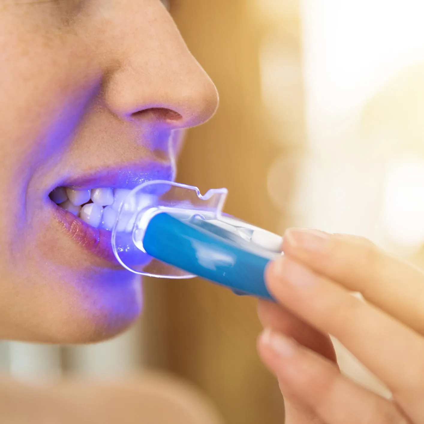 33789 teeth whitening hickory nc in office