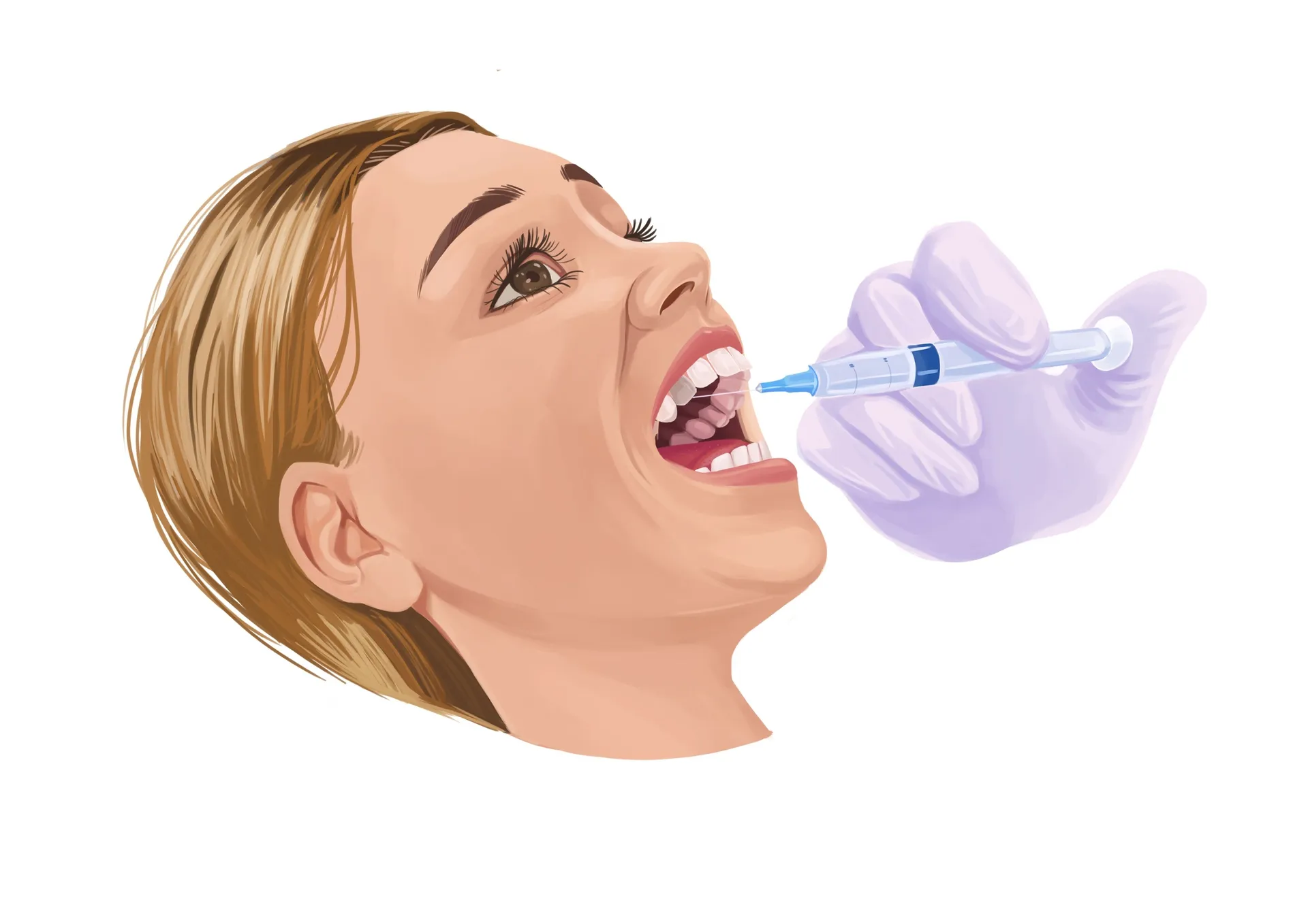 33791 professional teeth whitening