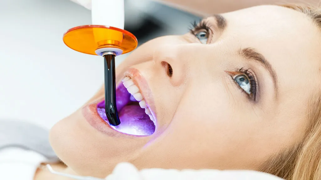 33810 in office teeth whitening