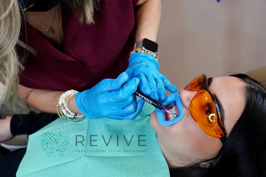 33825 in office teeth whitening