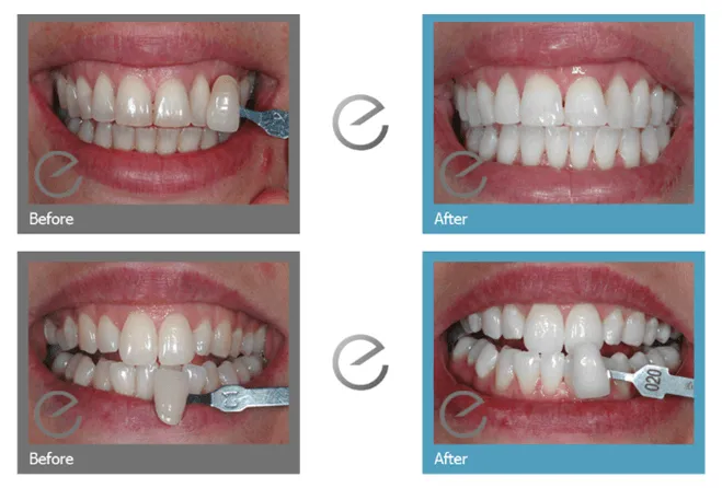 33832 dental hygiene practices