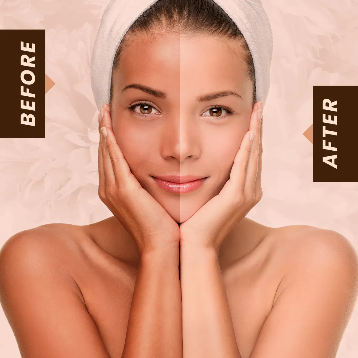 33849 skin whitening cream comparison