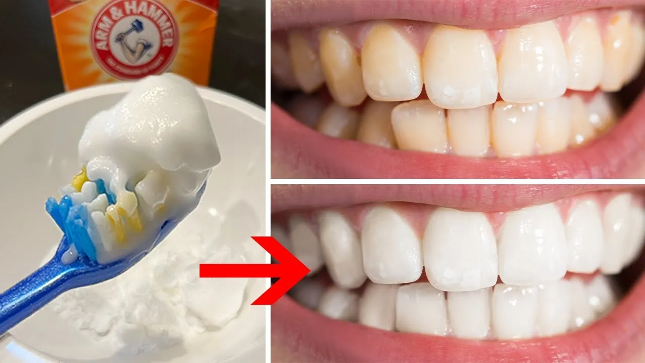 33855 teeth whitening alternatives
