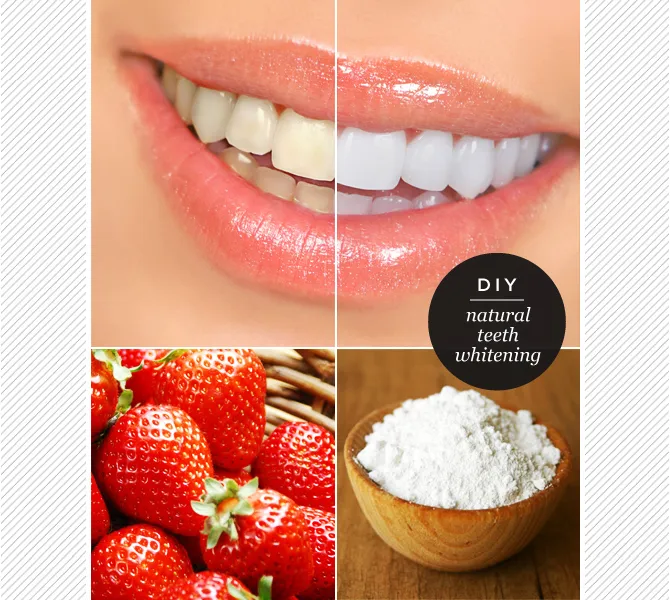 33861 strawberry teeth whitening main