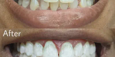 /img/33866-affordable-teeth-whitening-tips.webp
