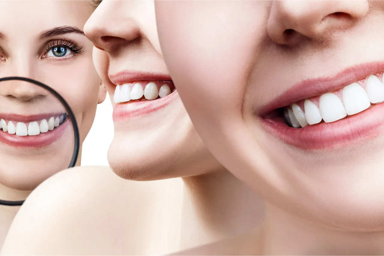 33871 tooth sensitivity