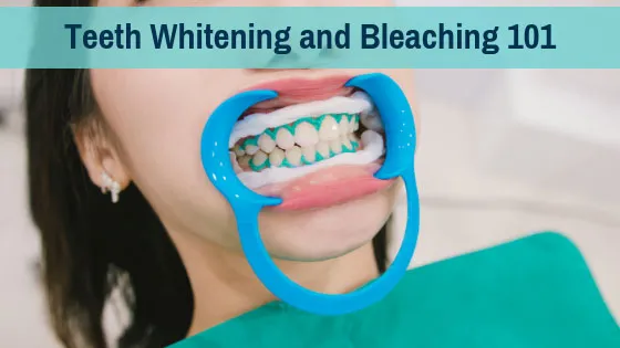 33882 dentist consultation