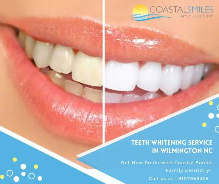 33892 teeth whitening wilmington nc 6