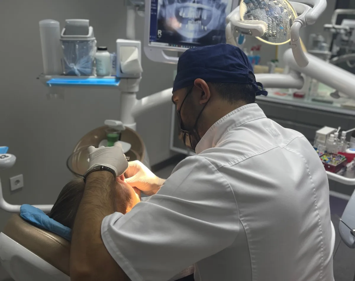 33895 teeth whitening before after