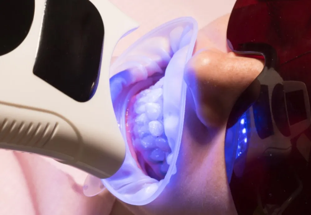 33895 teeth whitening clinic turkey