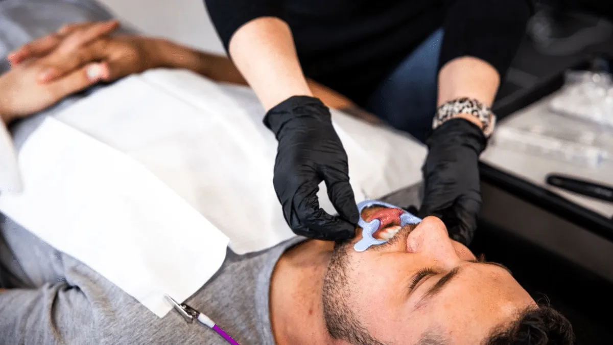 33904 bleaching at home