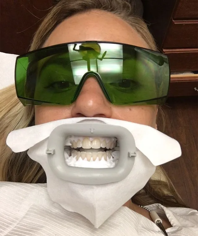 33905 hydrogen peroxide