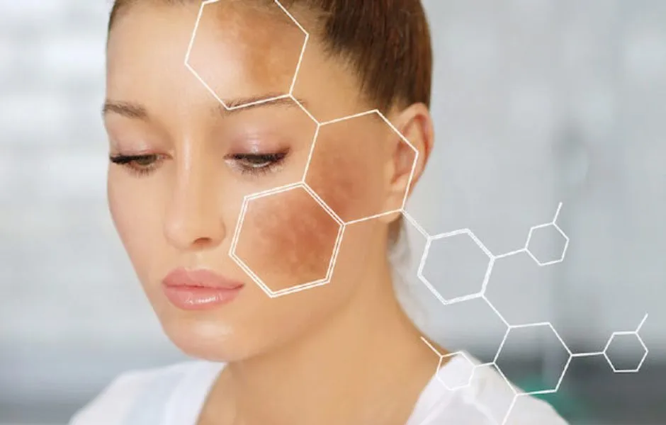 33906 whitening injection process