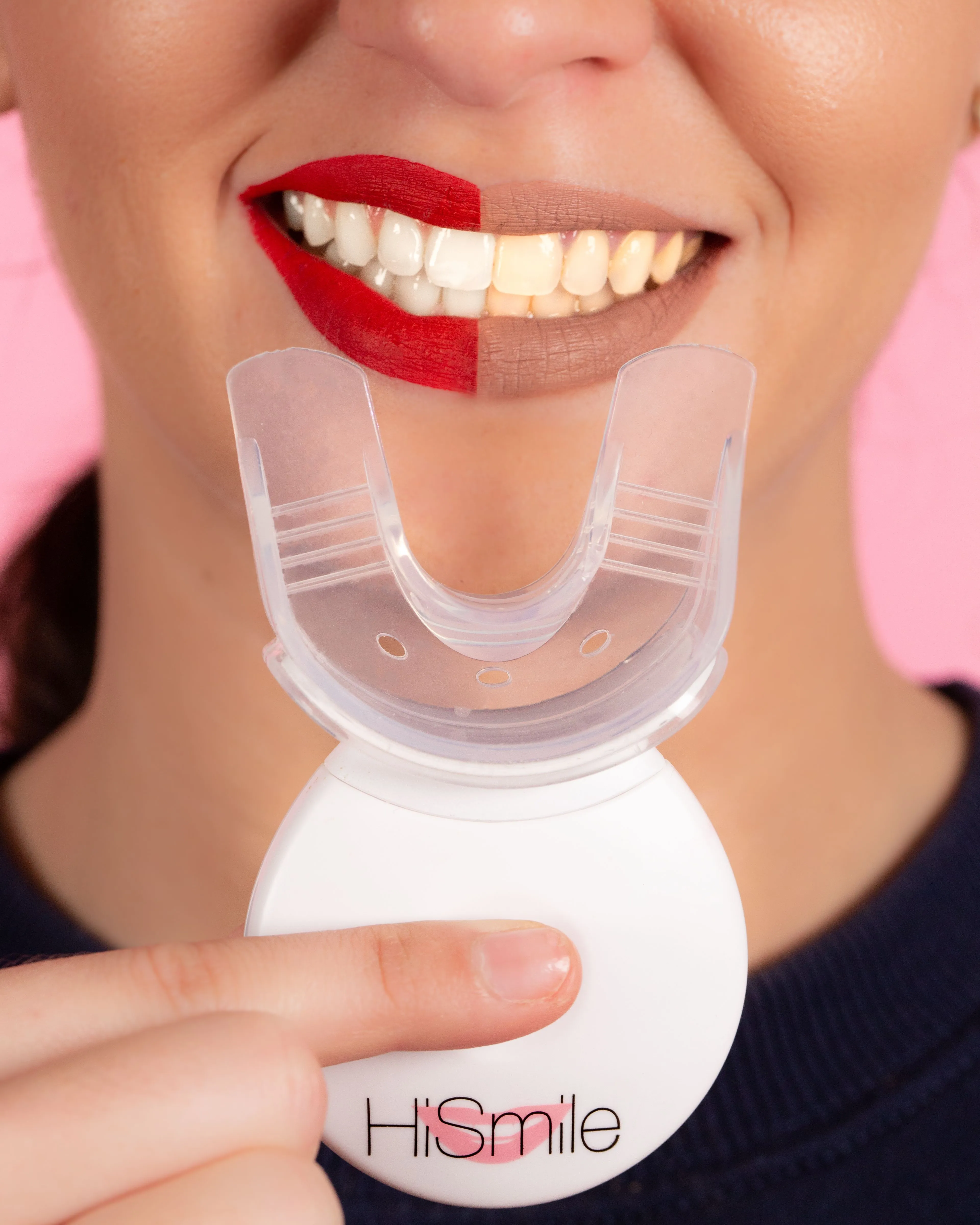 33911 applying whitening gel