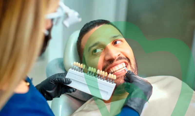 33913 teeth whitening process