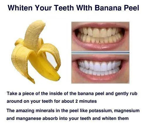 33914 teeth whitening banana peel process