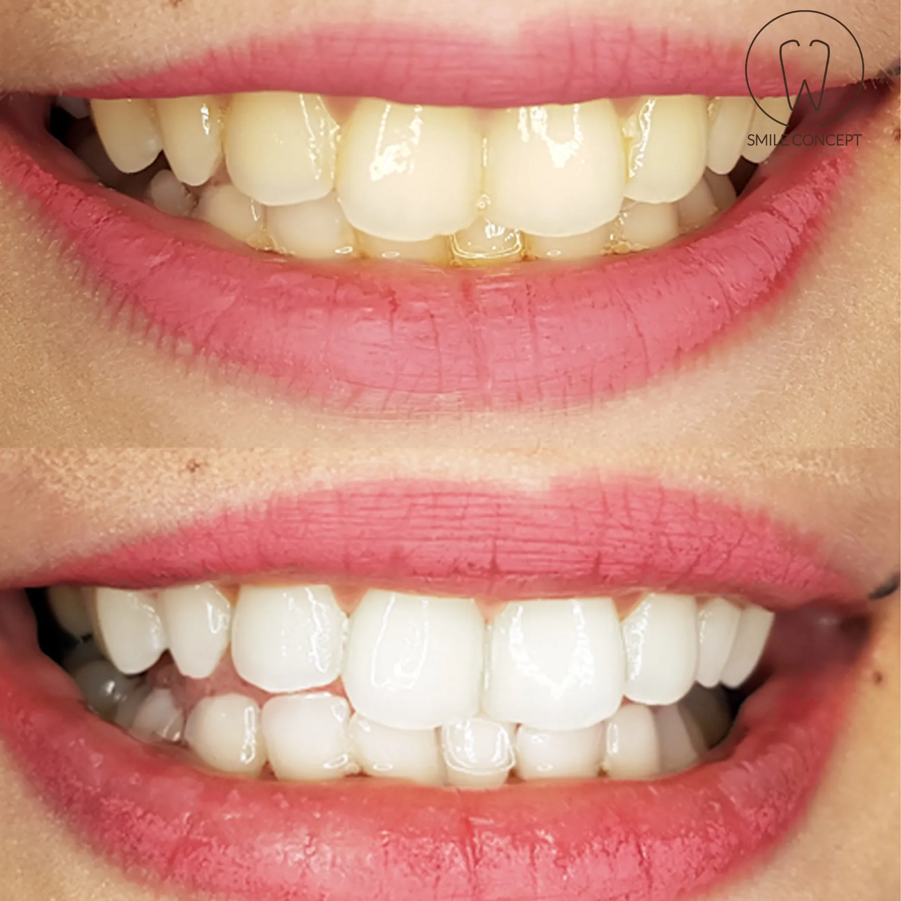 /img/33918-lumibrite-teeth-whitening-care-image8.webp