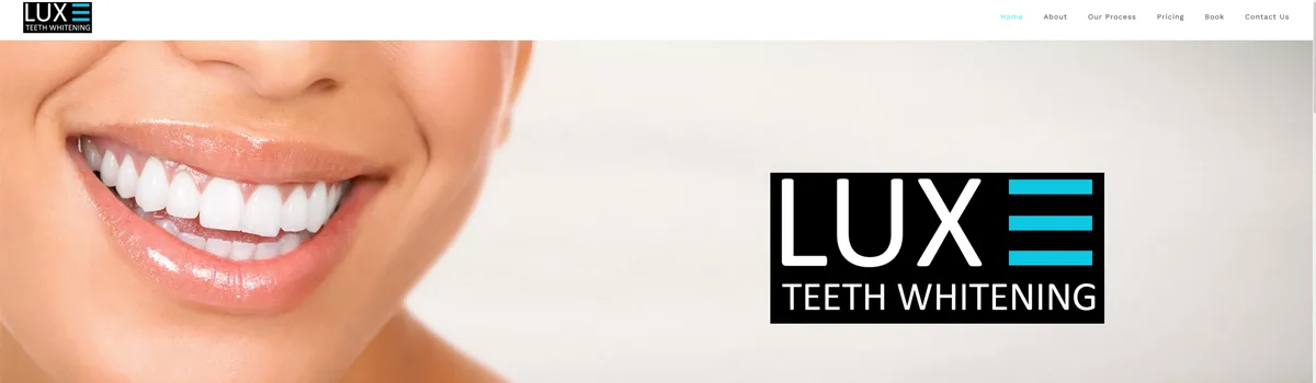 33926 lux teeth whitening consultation