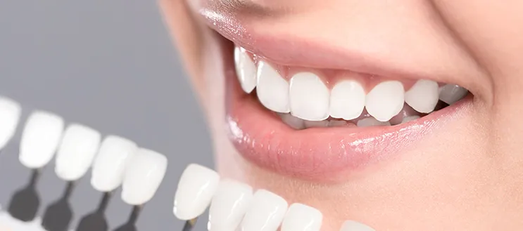 33927 foods to avoid teeth whitening