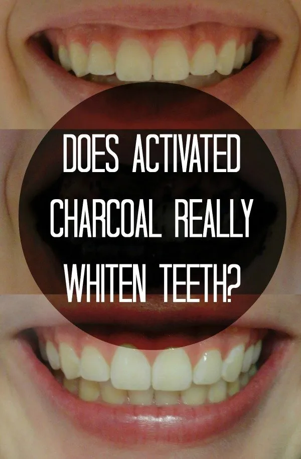 33933 charcoal teeth whitening 2