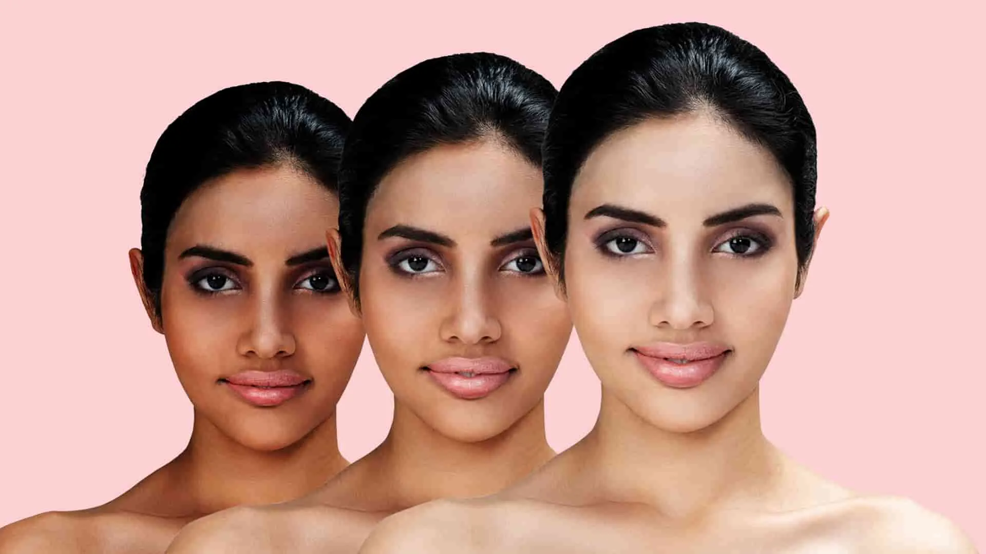 33943 hyperpigmentation