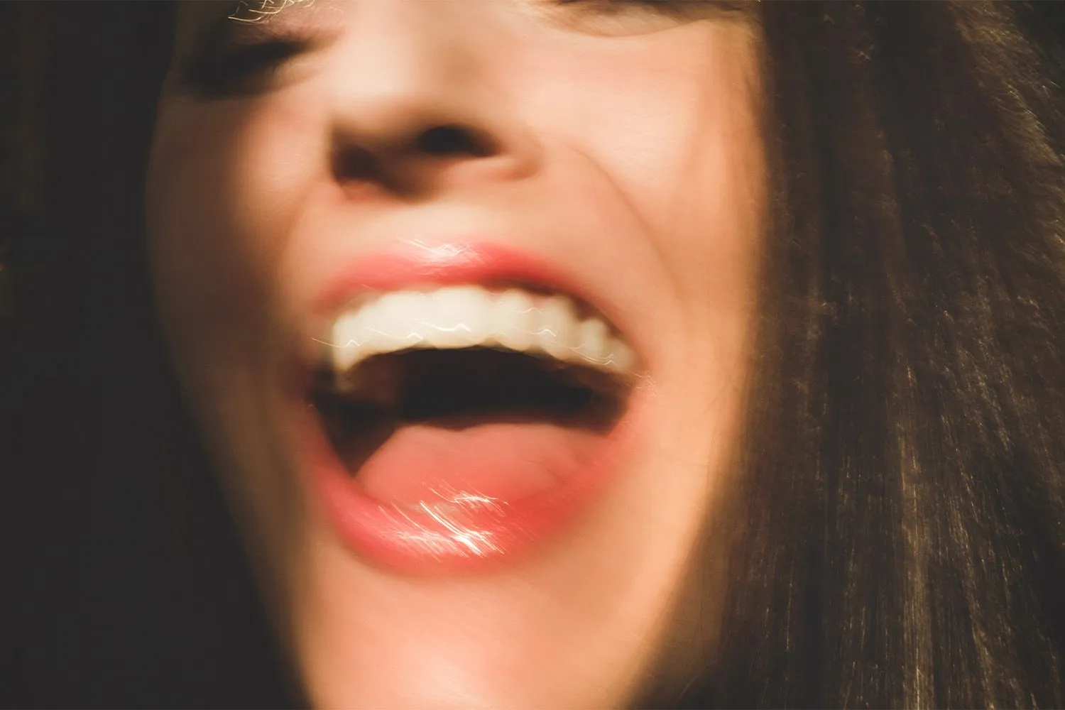 33944 best teeth whitening system 2