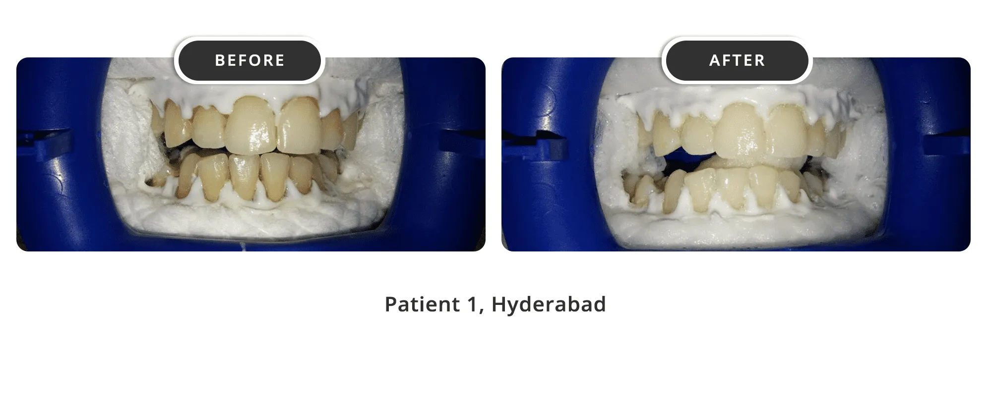 33949 oral hygiene maintenance