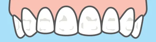 33960 underlying gum conditions