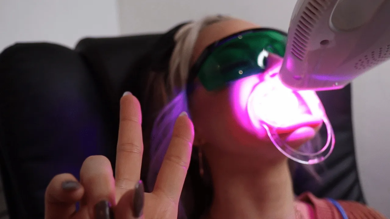 33972 at home bleaching kits