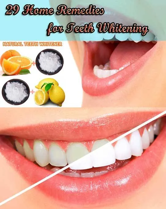 33976 teeth discoloration