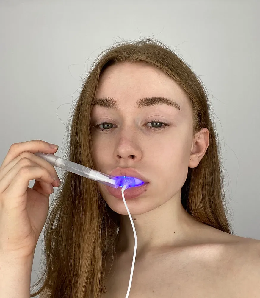 33979 in office teeth whitening