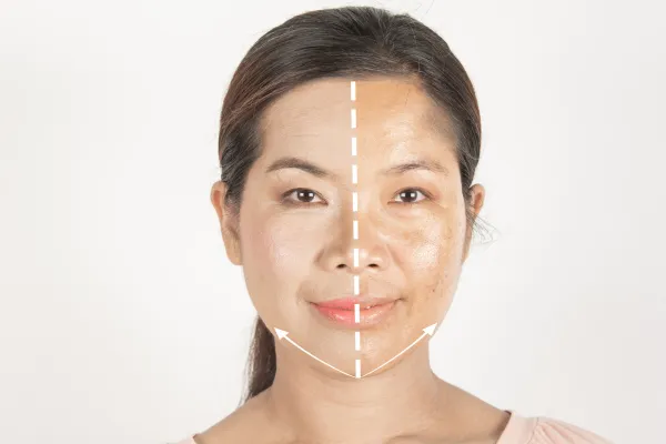 33981 vitamin c serum