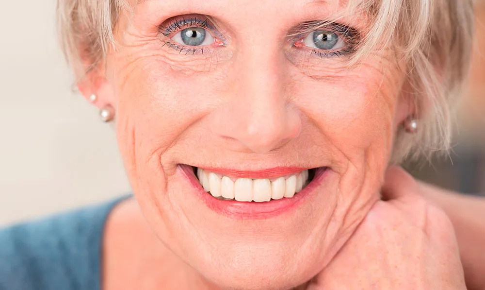 33983 local adjustments teeth whitening