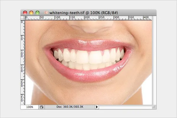 33983 professional retouching teeth