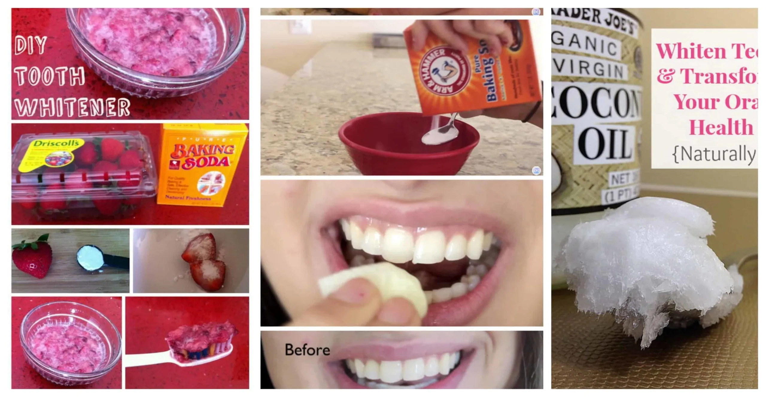 33985 apple cider vinegar teeth