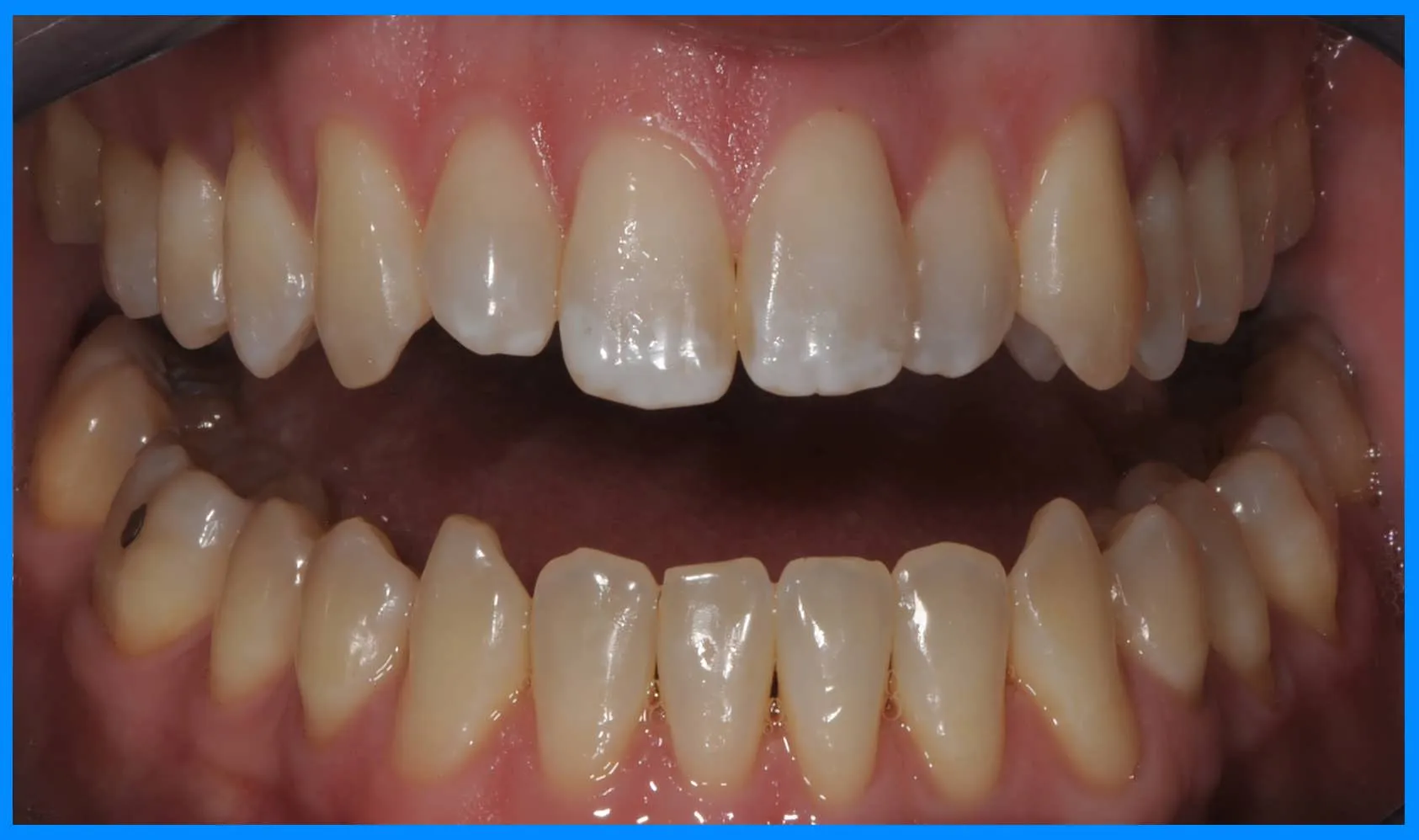 33991 zoom whitening scottsdale az candidate