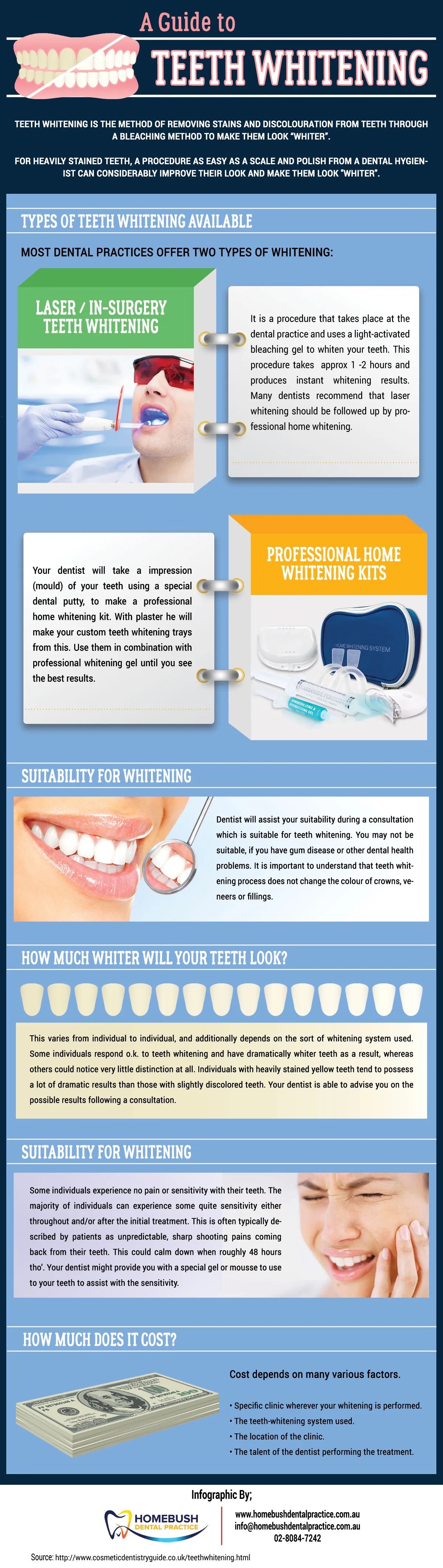 /img/33996-teeth-whitening-maintenance.webp