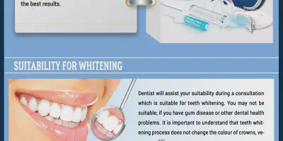 /img/33996-teeth-whitening-maintenance.webp